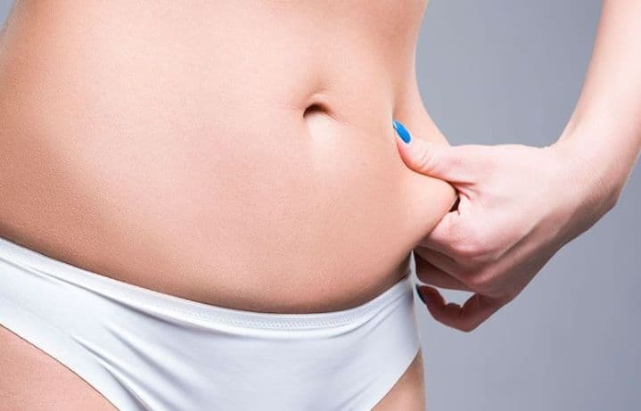 Abdominoplastia